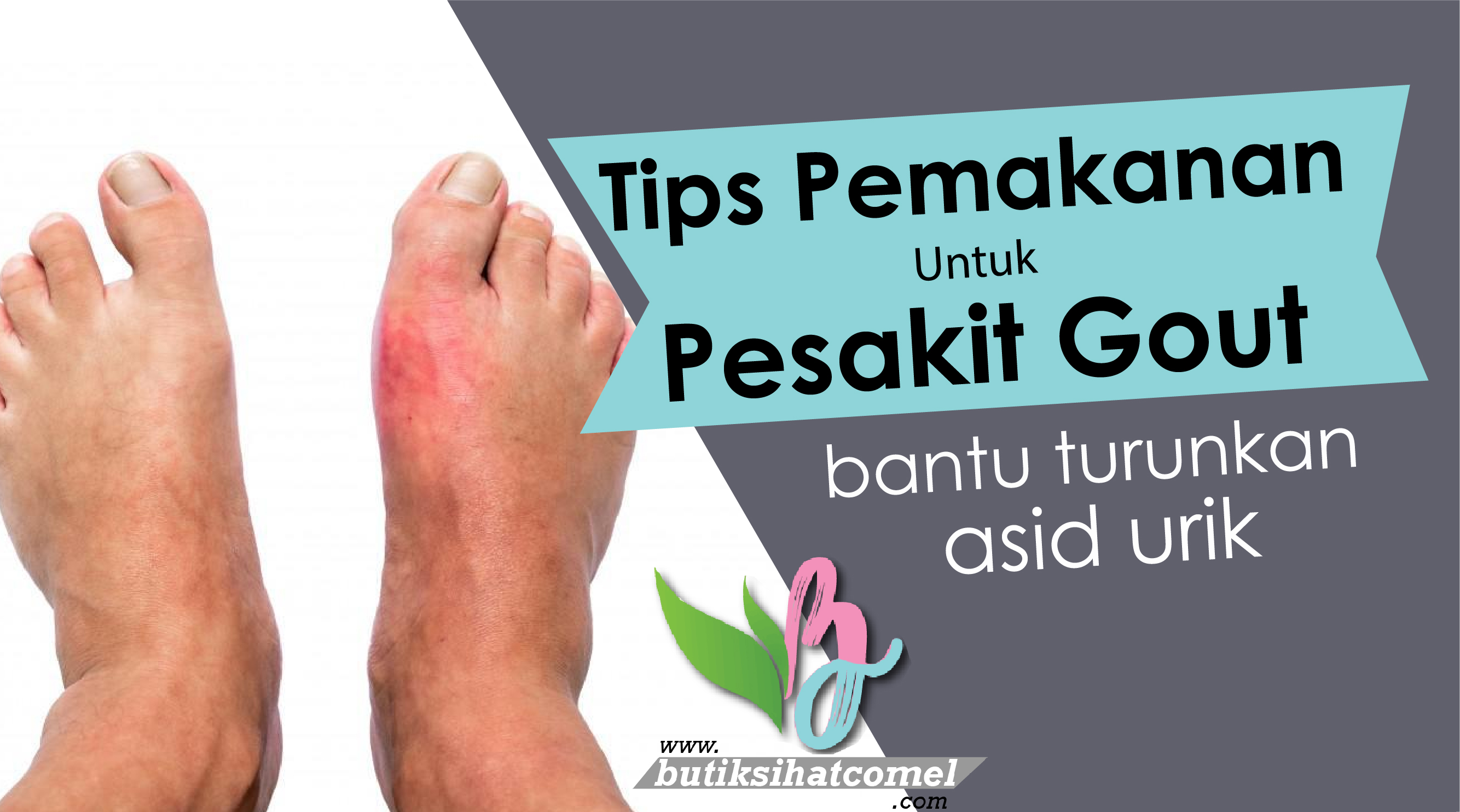 Tips Pemakanan Untuk Pesakit Gout