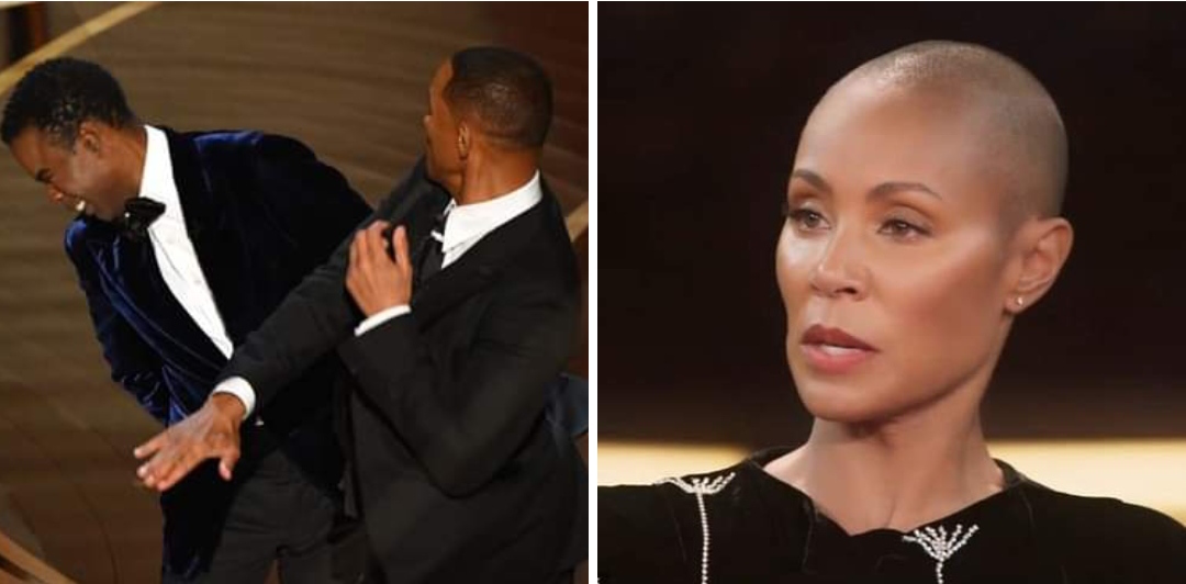 Alopecia Kepala Botak ?