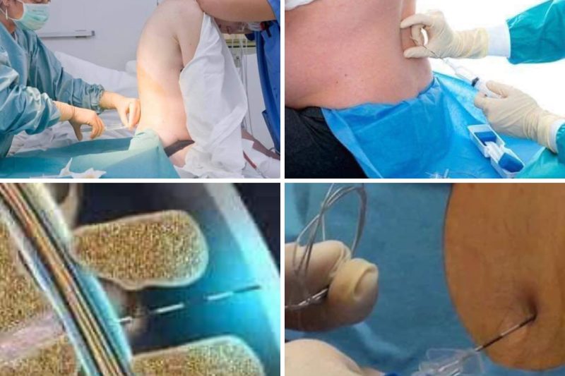 Emergency Czer – Pengalaman Dari Seorang Ibu Anak 4