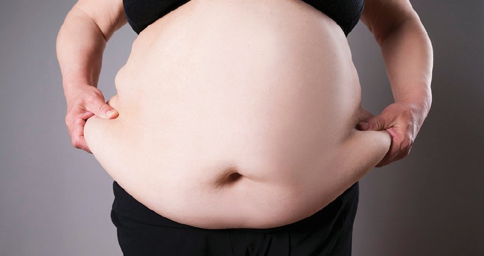 Obesiti Asia Tenggara