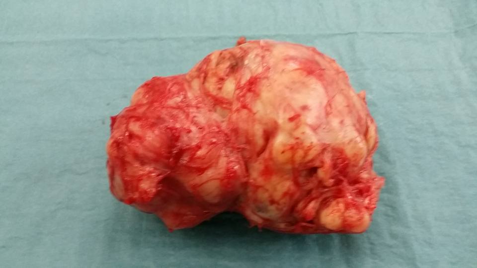 Cara Jaga Rahim Wanita