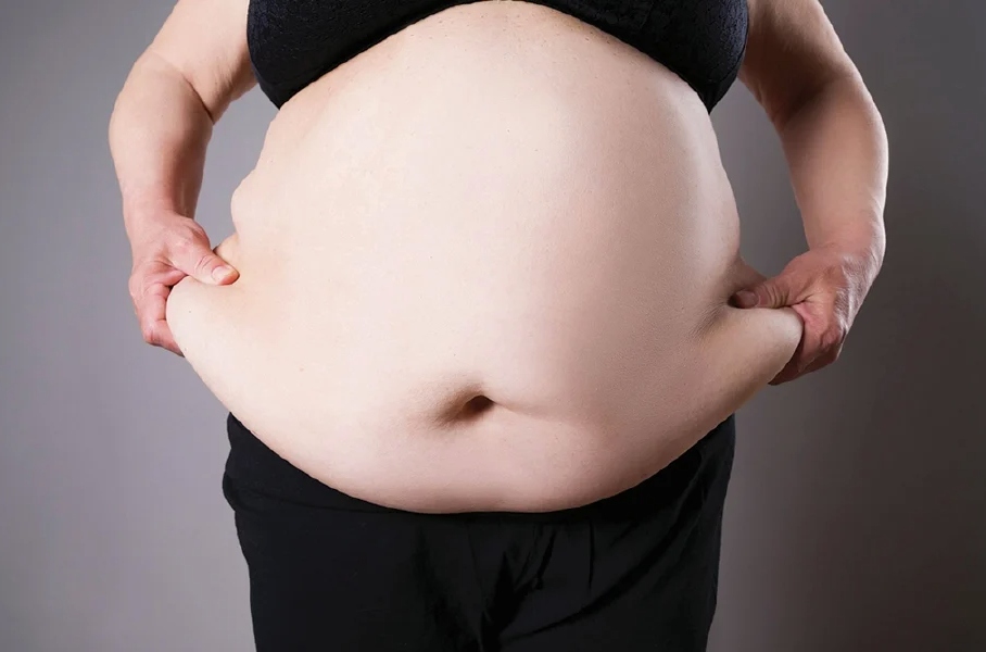 kencing manis obesiti buncit