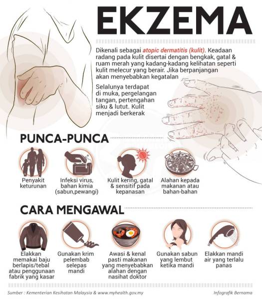 Kesan Steroid Rawat Eczema: Pulihkan Ekzema Tanpa SteroidPulihkan Ekzema Tanpa Steroid