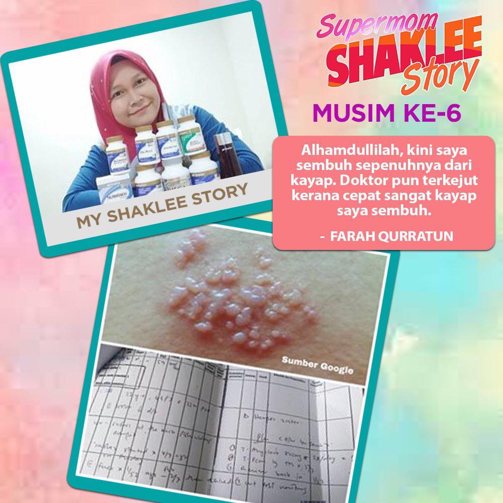 Cara Merawat Kayap Dengan Berkesan