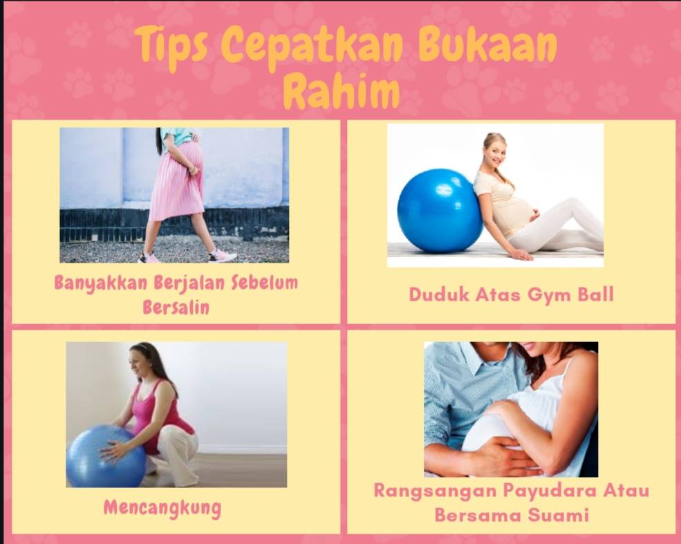 Senaman Cepatkan Proses Bersalin Elak Overdue